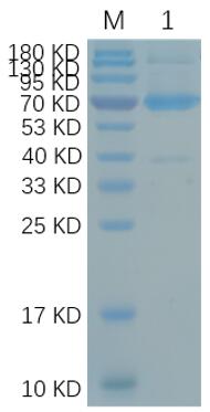 Reducing 12% SDS-PAGE analysis profile of purified TACI (CBB stained).